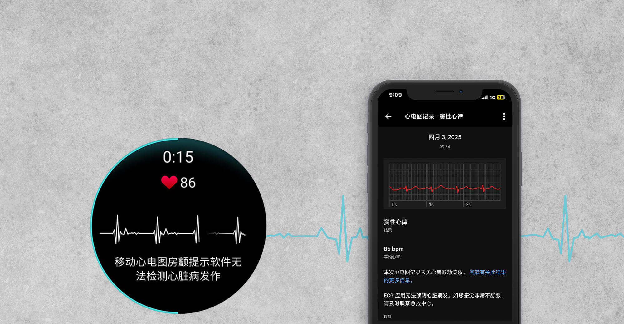 GARMIN ECG APP