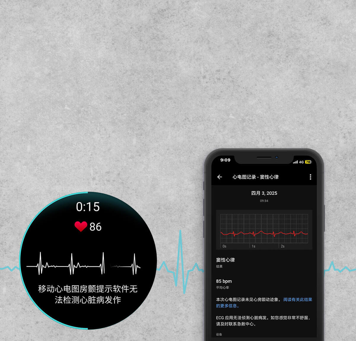 GARMIN ECG APP